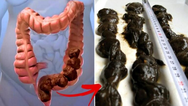 Questo semplice gesto ti permette di disintossicare il colon in pochi giorni…